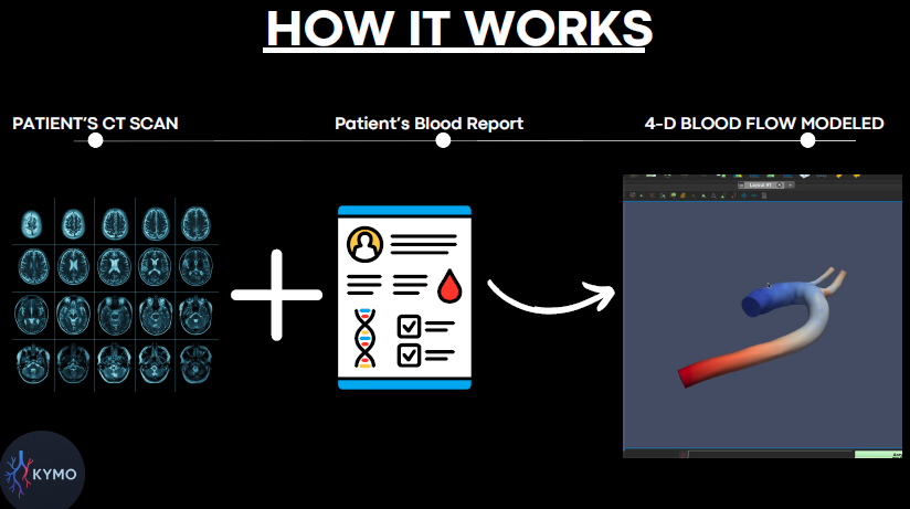 Kymo Surgical Planning AI Solution